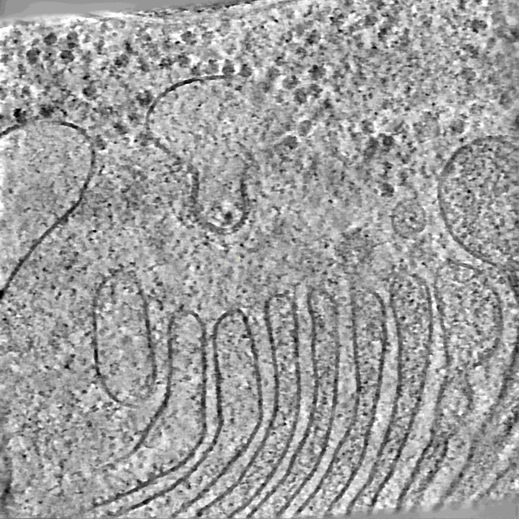 Cryo-electron tomography image